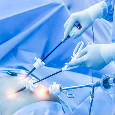 Laparoscopic surgery in Vijayawada