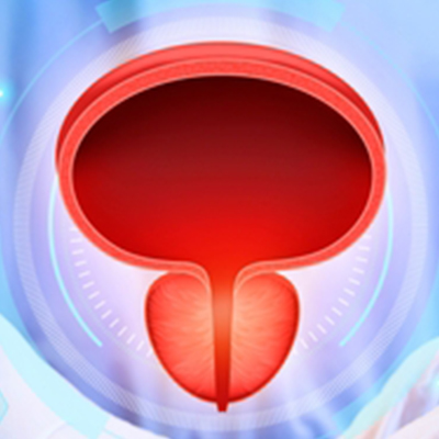 prostate cancer treatment in Vijayawada